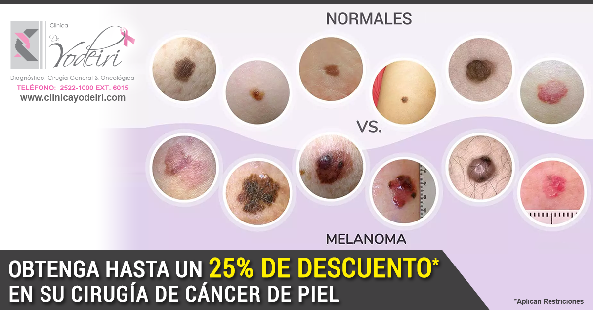 nota-mar-20-7